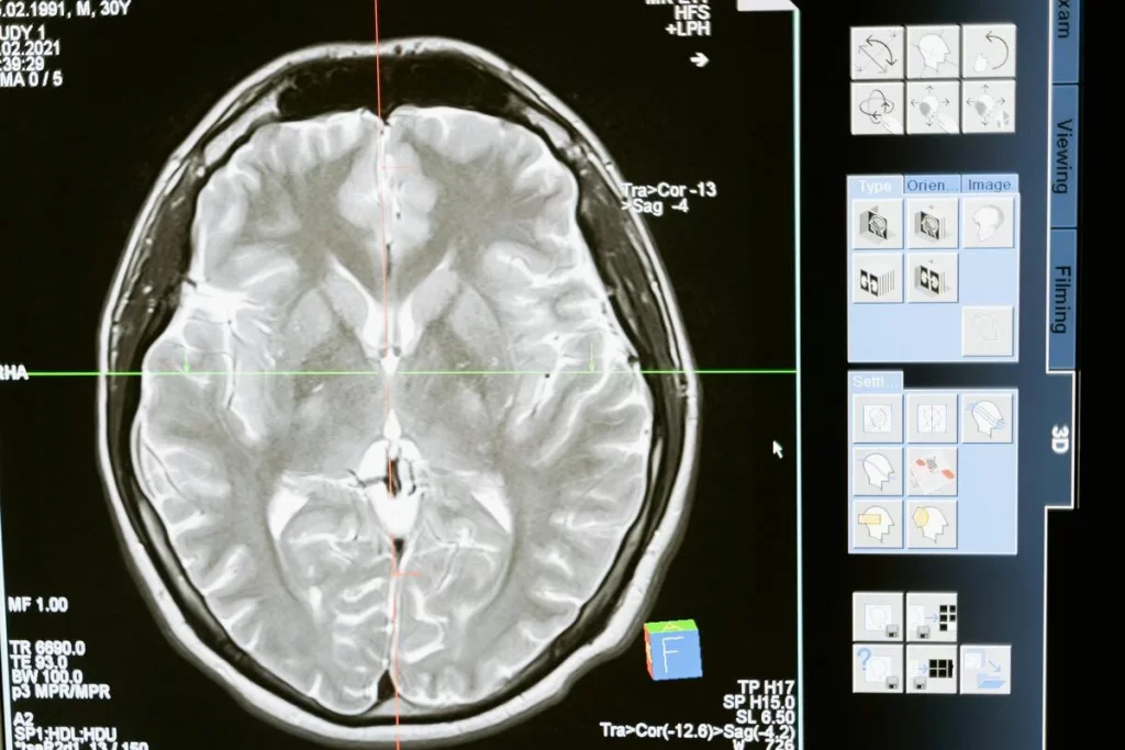 neurociencia-cognitiva