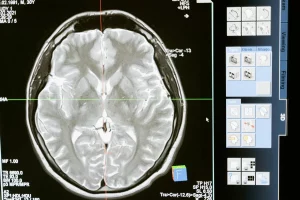 neurociencia-cognitiva